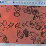 Thrombozyten-Aluminiumoxid